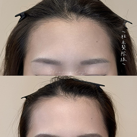 SLook 紋髮際線