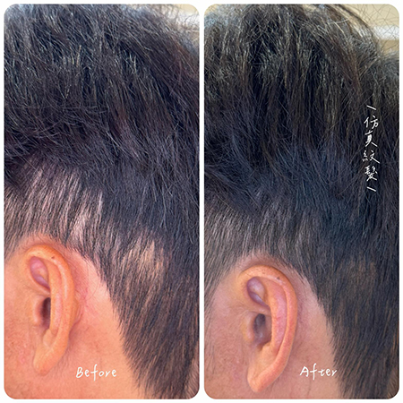 SLook 紋髮際線成果